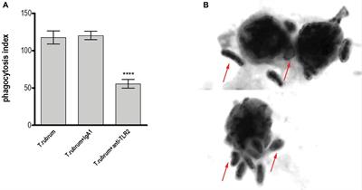 Trichophyton rubrum Elicits Phagocytic and Pro-inflammatory Responses in Human Monocytes Through Toll-Like Receptor 2